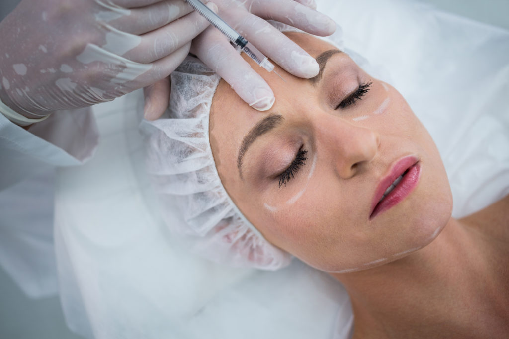 Comment se passe les injections de Sculptra ?