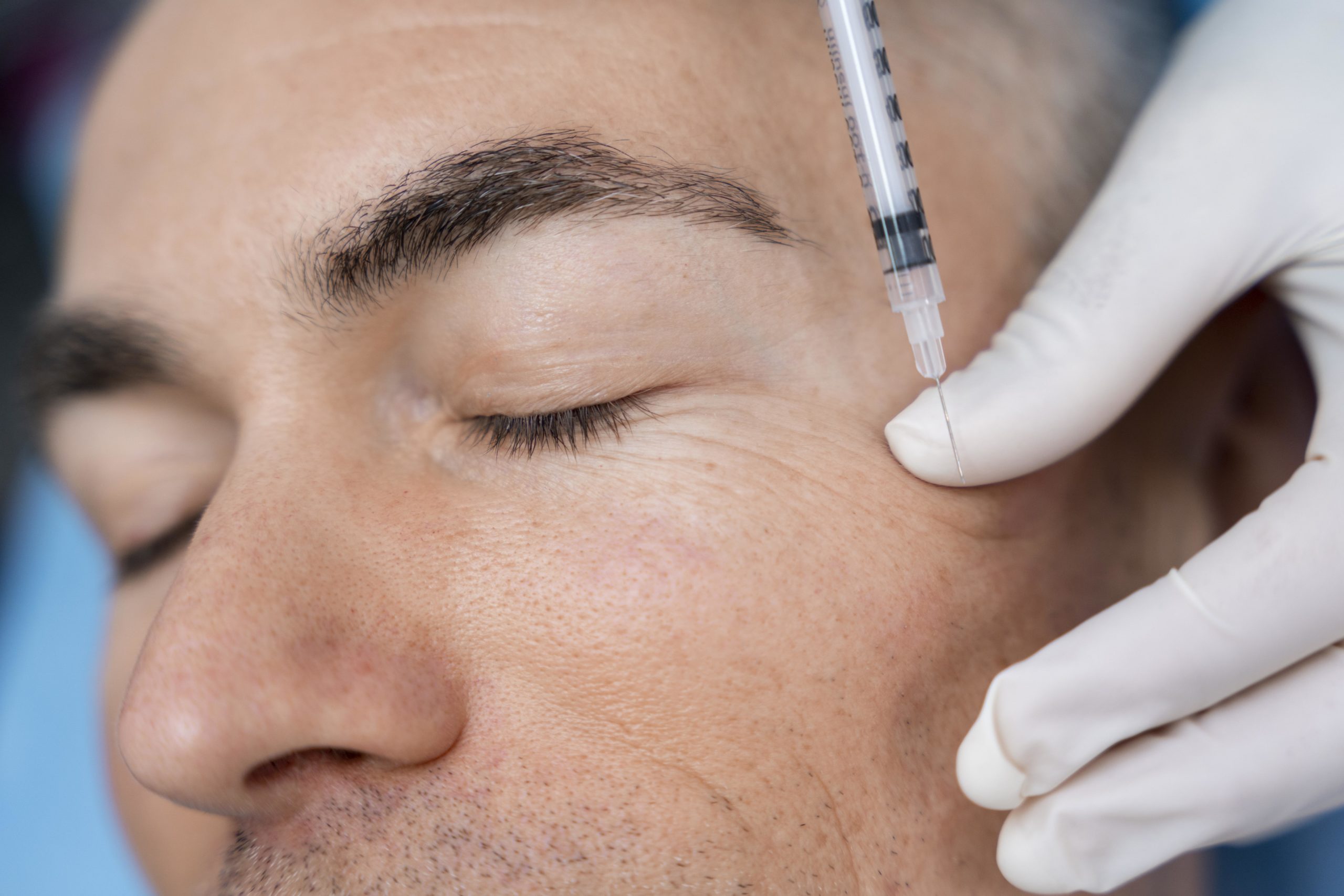 Injections Acide hyaluronique : Quels résultats à Lausanne