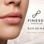 Injections lèvres visage Lausanne