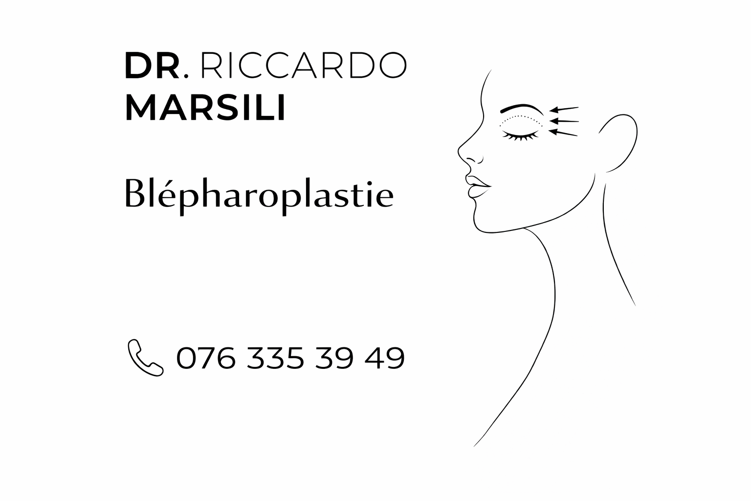 Tout savoir sur la blépharoplastie en Suisse