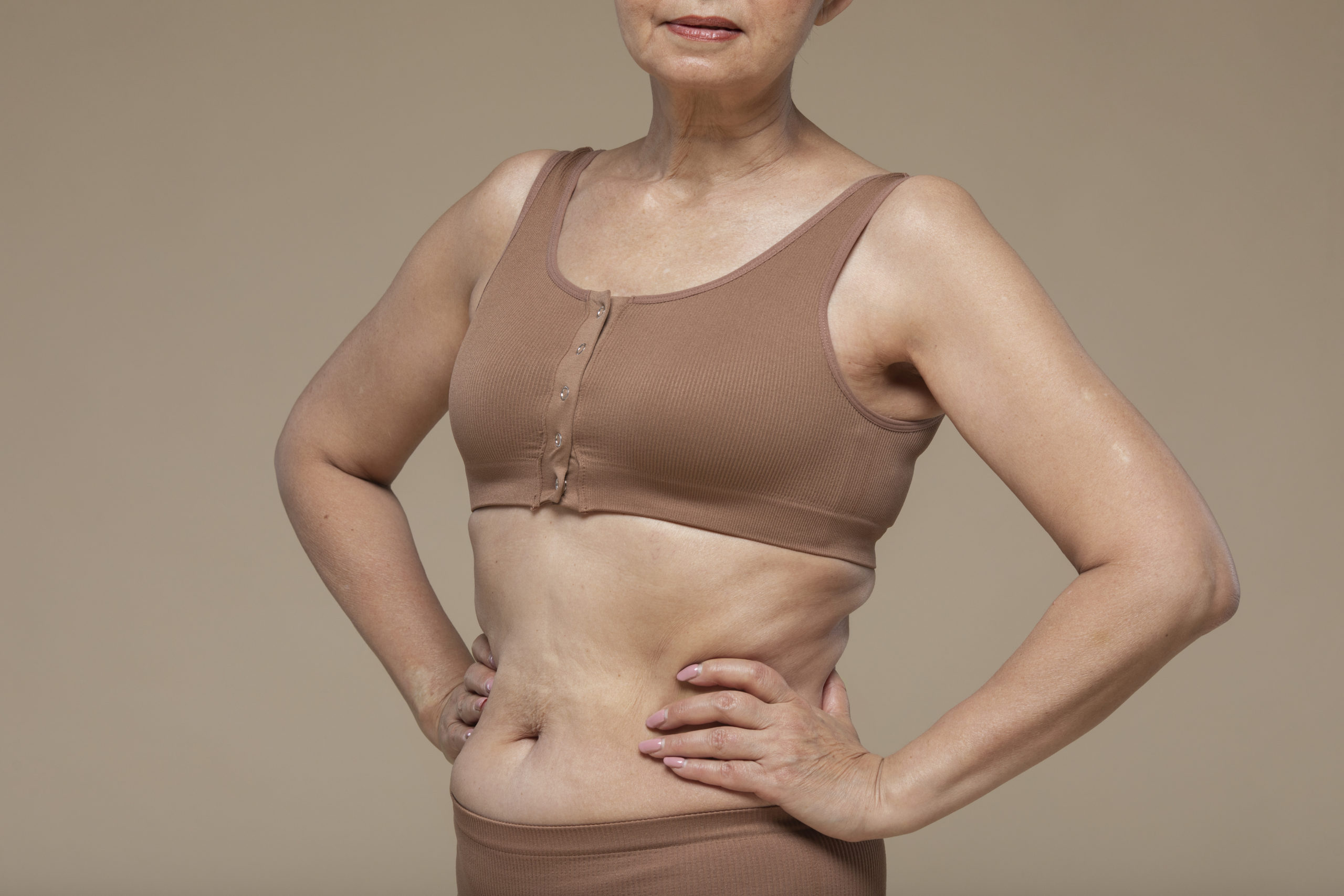 Lexique complet sur l’abdominoplastie